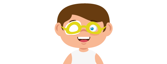 L’ambliopia, detta più comunemente “occhio pigro”, è un disordine della vista in cui un occhio non sviluppa una acuità visiva normale